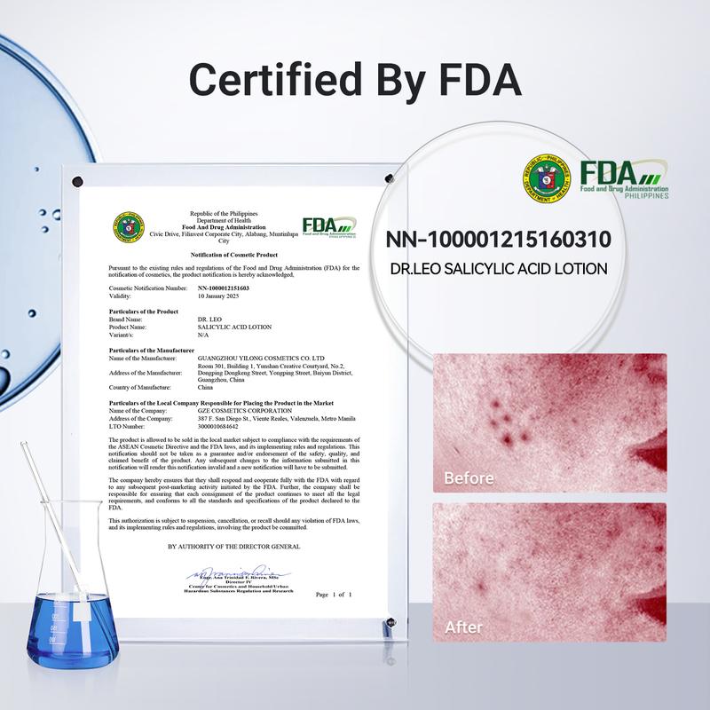 24-Hour Acne Drying Lotion