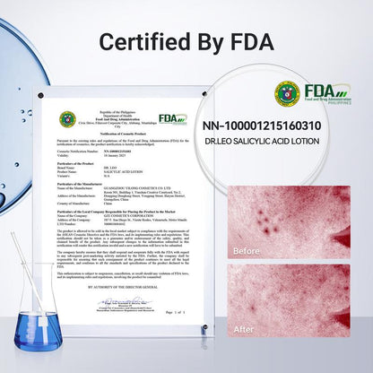 24-Hour Acne Drying Lotion